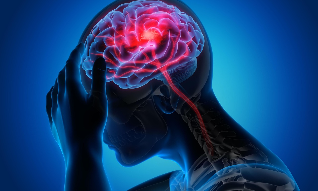 Understanding Headaches: Types, Triggers, and Effective Treatment in Kathmandu