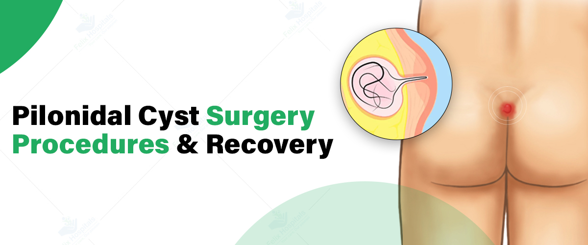 Open Surgery vs. Laser vs. Limberg Flap for Pilonidal Sinus: Your Complete Guide at Inova Hospital, Kathmandu